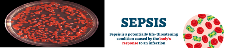 images show a petri dish full of ominous red bacteria and the words "Sepsis: Sepsis is a potentially life-threatening condition caused by the body's response to an infection"
